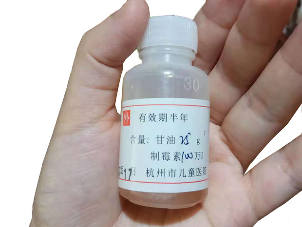 寶寶嘴里長(zhǎng)了白色斑點(diǎn)，很可能是鵝口瘡